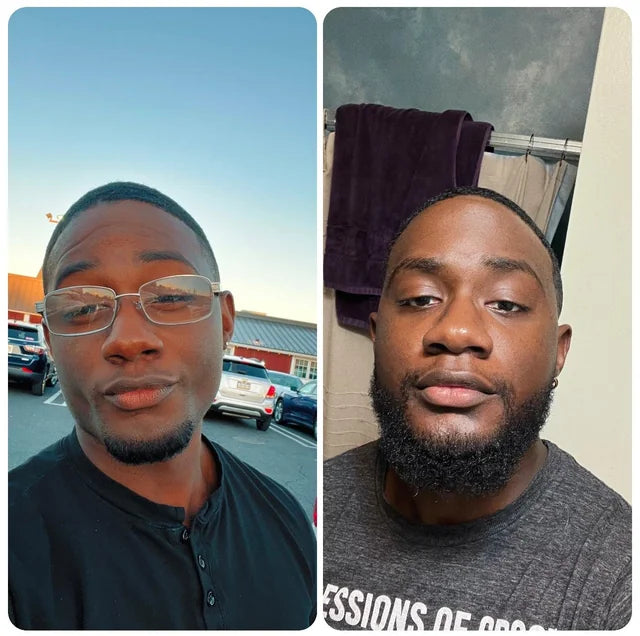 L’histoire de Marcus : de joues nues à barbe complète