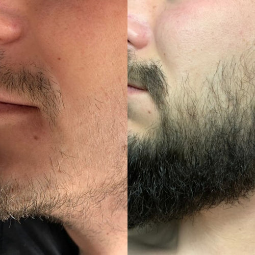 Signes que ta barbe pousse (même si tu ne le vois pas encore)