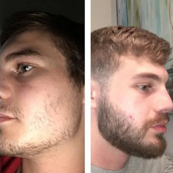 Pack Duo - Sérum & Roller