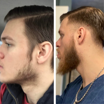 Pack Duo - Sérum & Roller